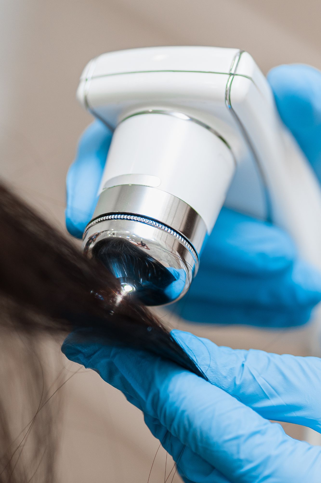 Best Hair loss treatment in Indore
