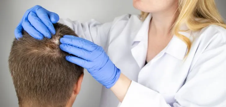 alopecia treatment in Indore