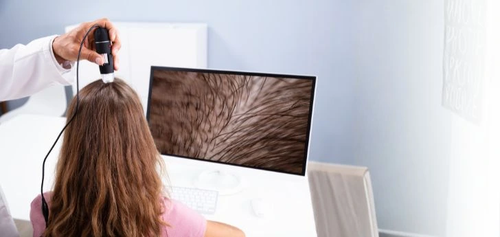 Best hair fall treatment in Indore